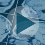 Alzheimer's Diagnostics