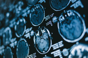 brain